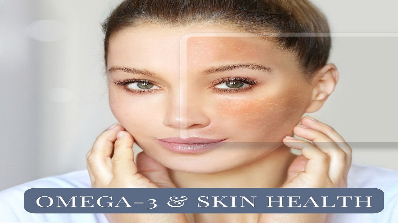 Food Choices: Role of Omega 3 Fatty Acids in Healthy Skin